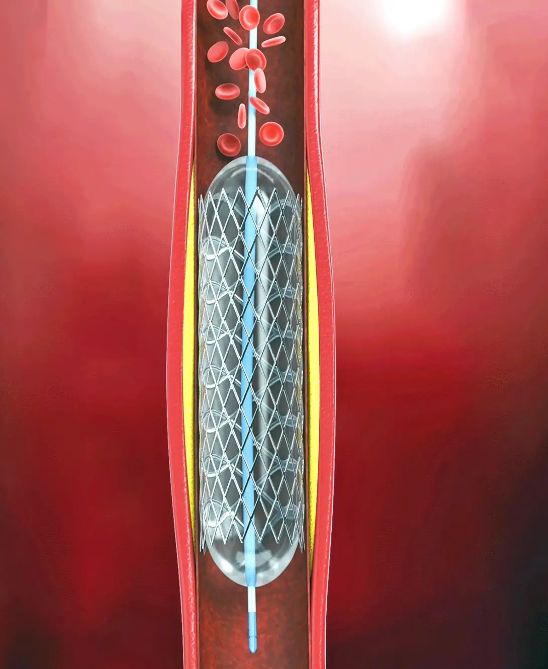 Medical - Scantech Laser